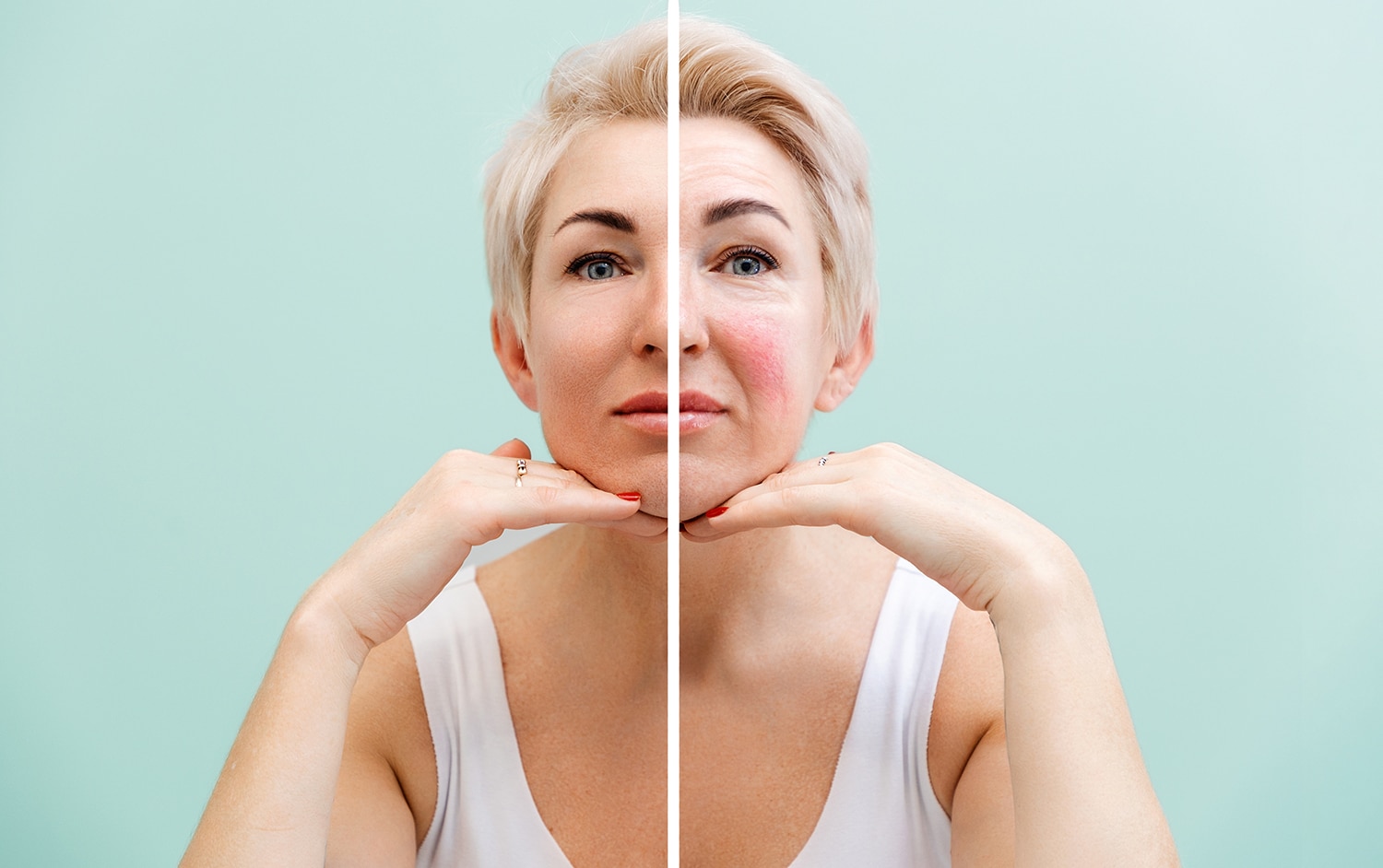 Professional cosmetology. Portrait of a adult caucasian woman with facial changes after procedure. The face is divided into two parts - the result before and after treatment.