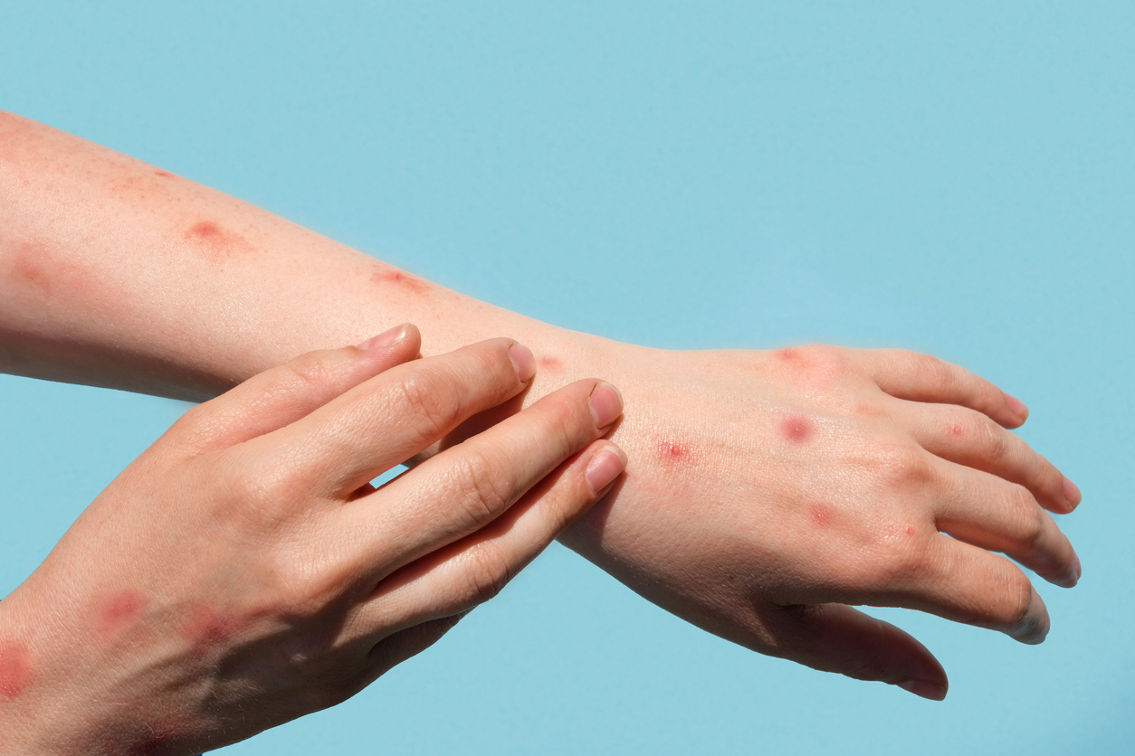 common skin allergens