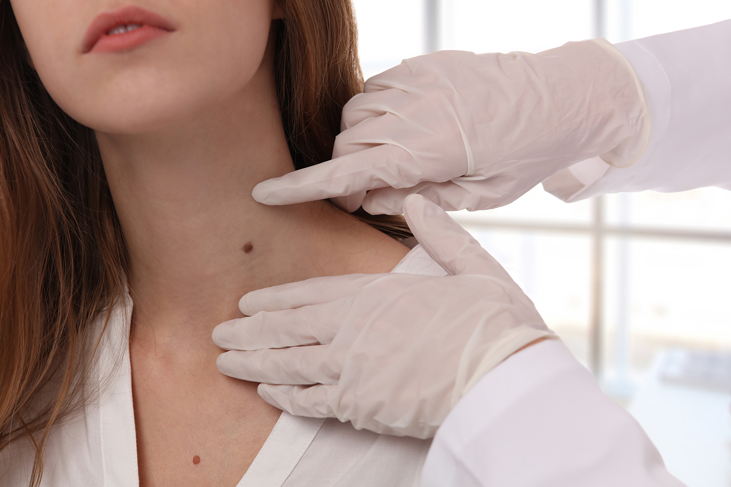 Monitoring Your Skin & Identifying Skin Cancer (When to See a Dermatologist)