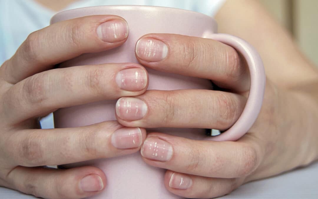 Top 7 Signs of Unhealthy Nails You Shouldn’t Ignore
