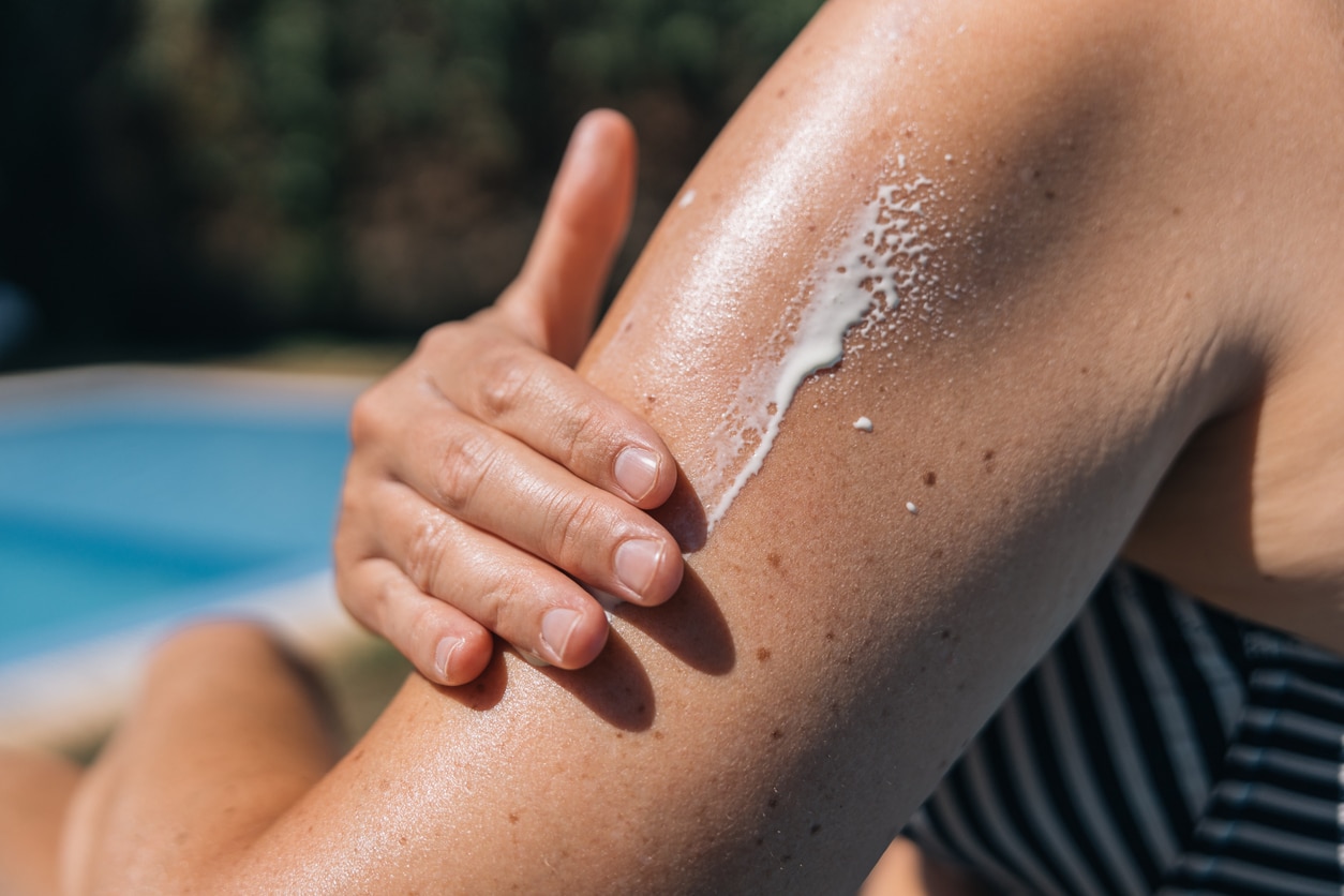 Close-up of a woman's hand applying sunscreen, concept of prevention and skin care